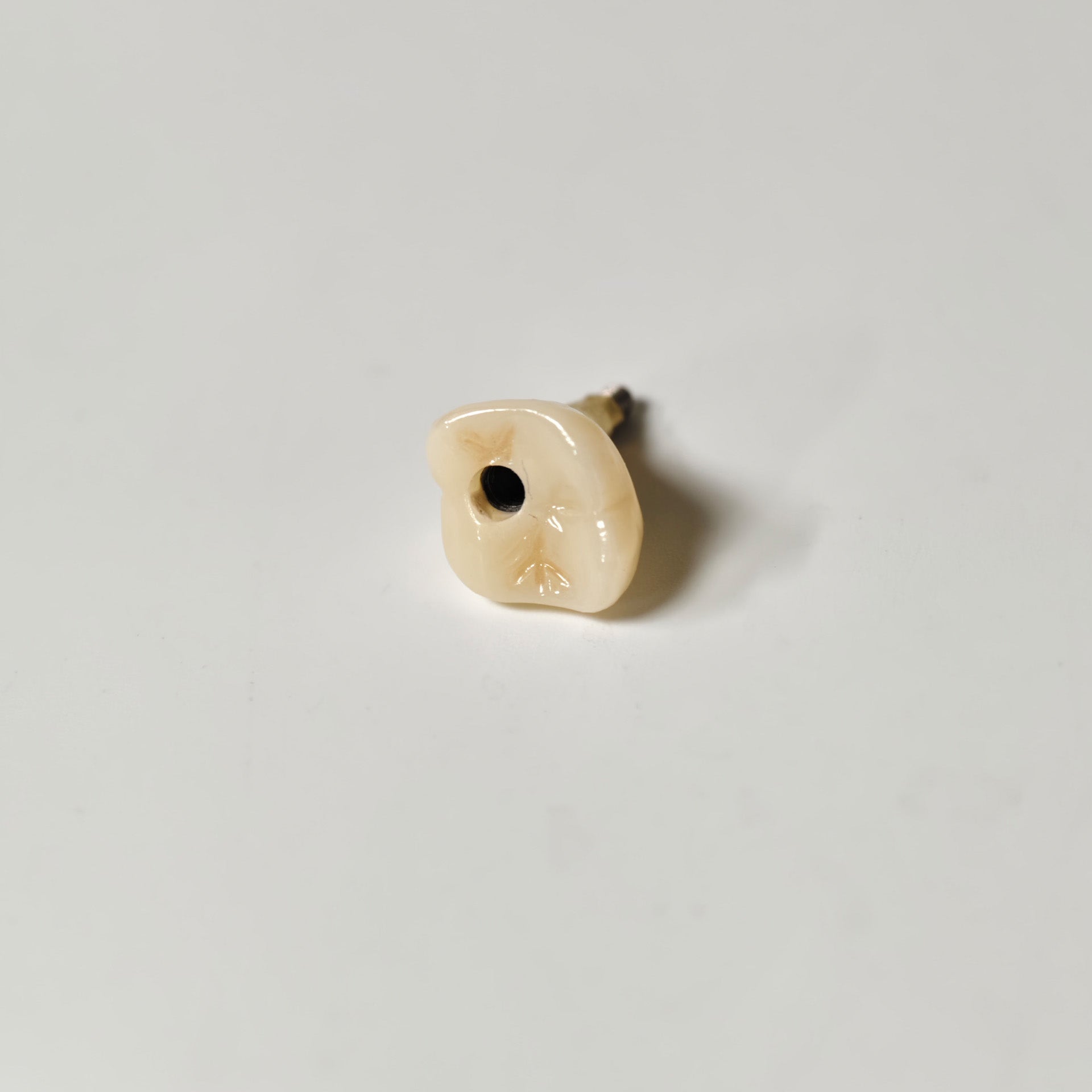 Zirconia Crown With Screw Retained
