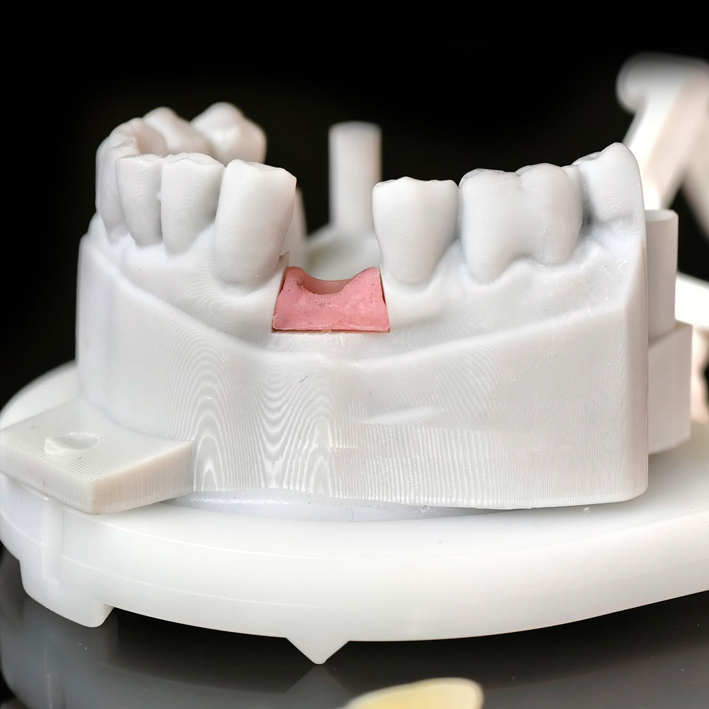 Zirconia Crown With Screw Retained