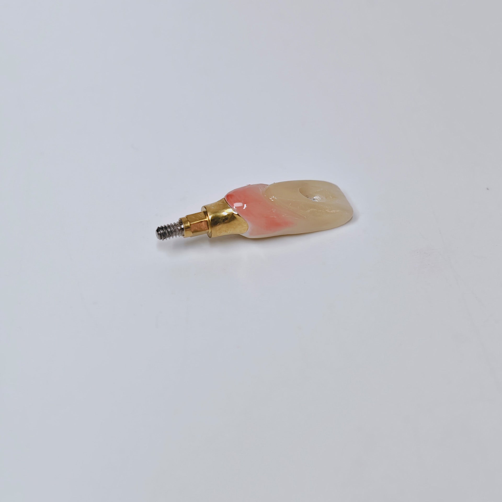 Zirconia Crown With Screw Retained