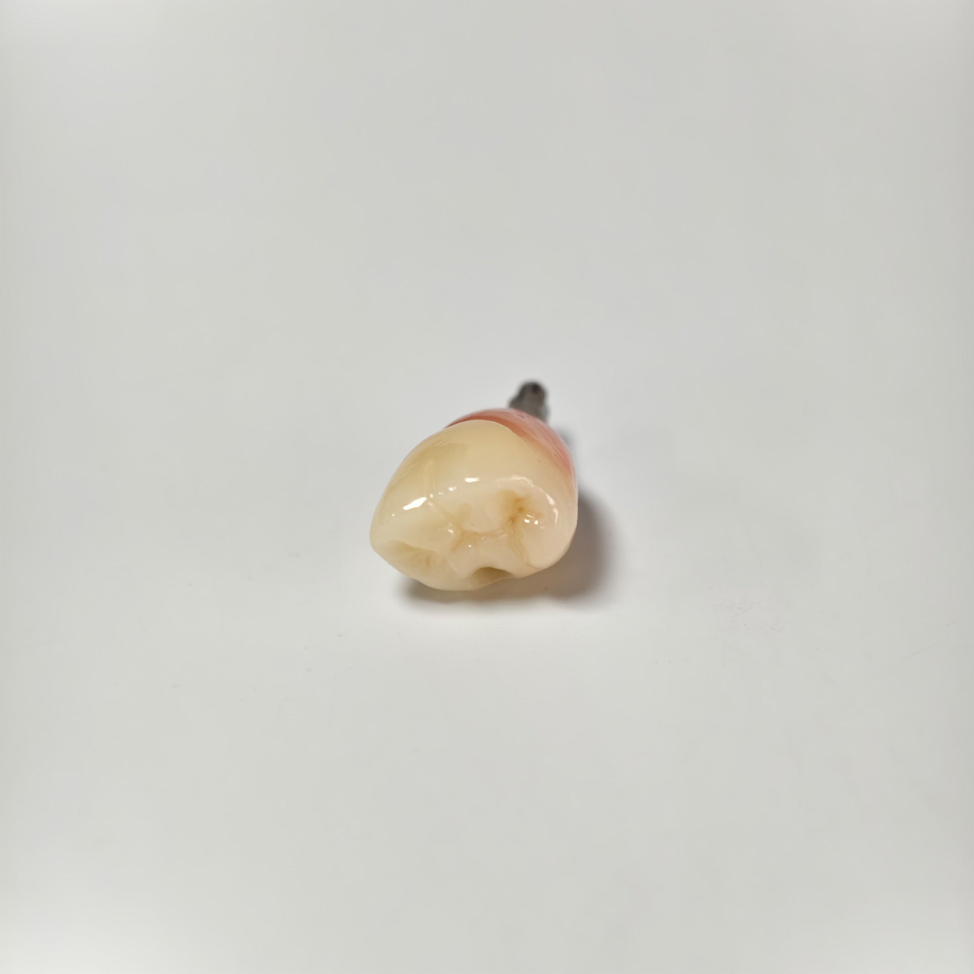 Zirconia Crown With Screw Retained