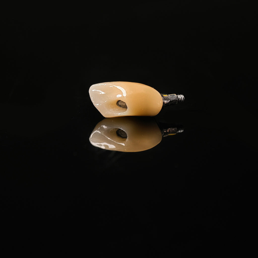 Zirconia Crown With Screw Retained
