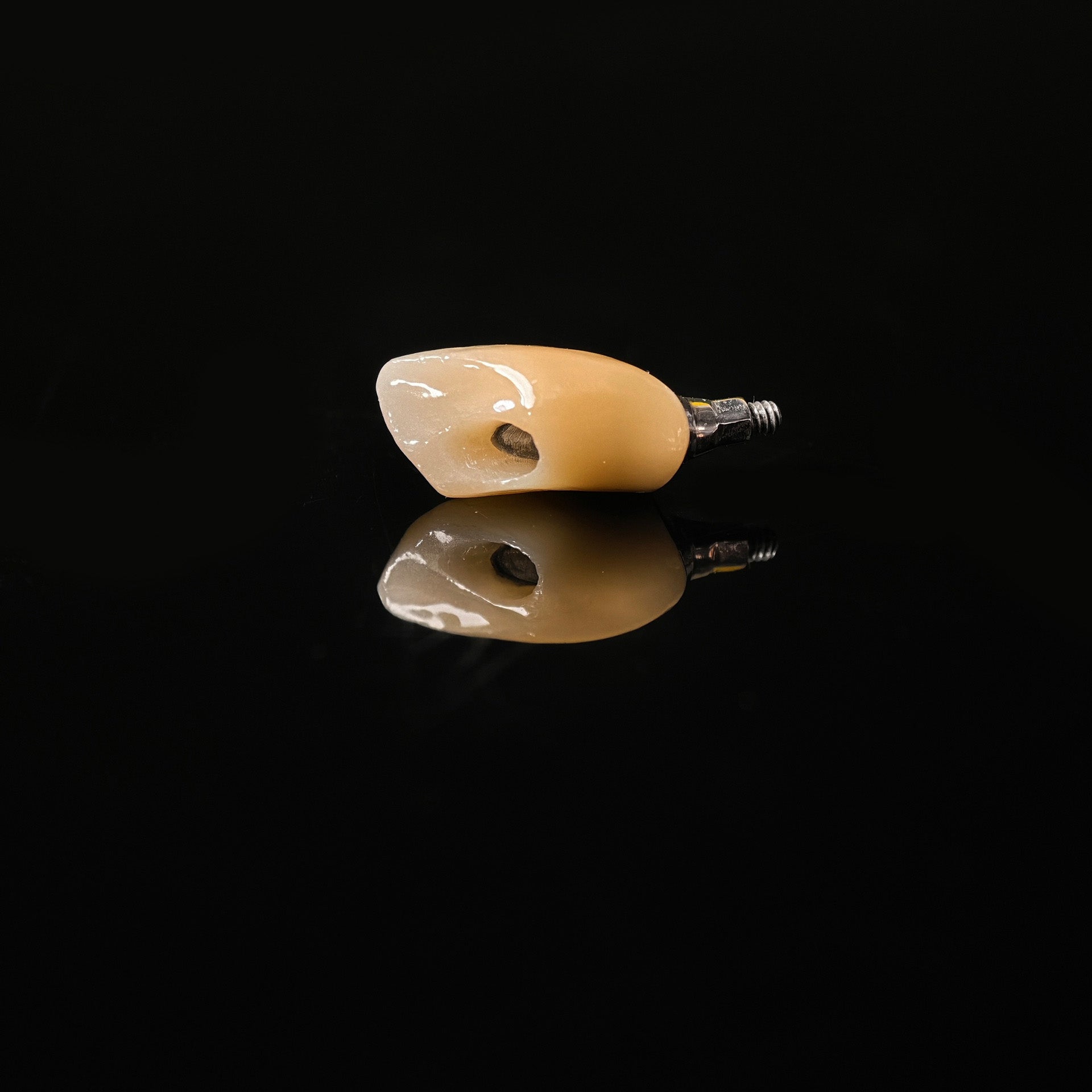 Zirconia Crown With Screw Retained