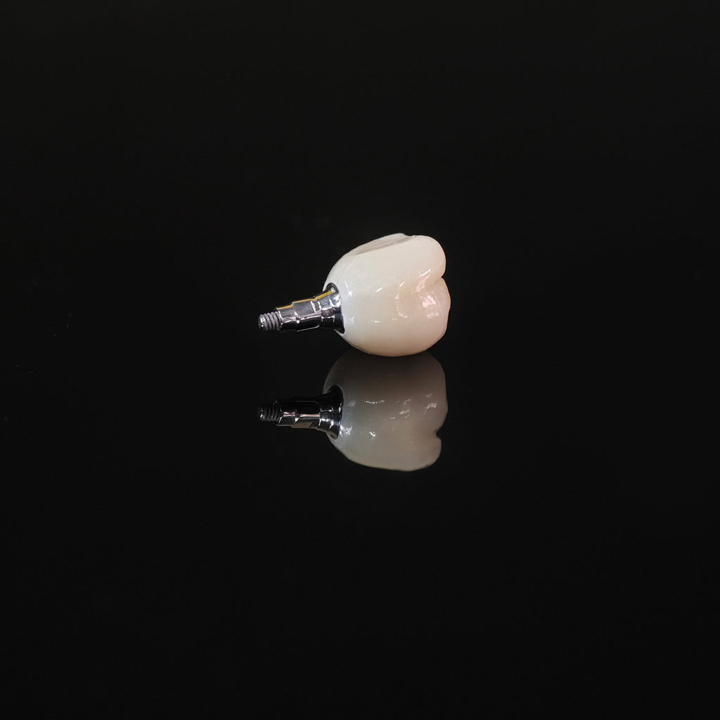 Zirconia Crown With Screw Retained