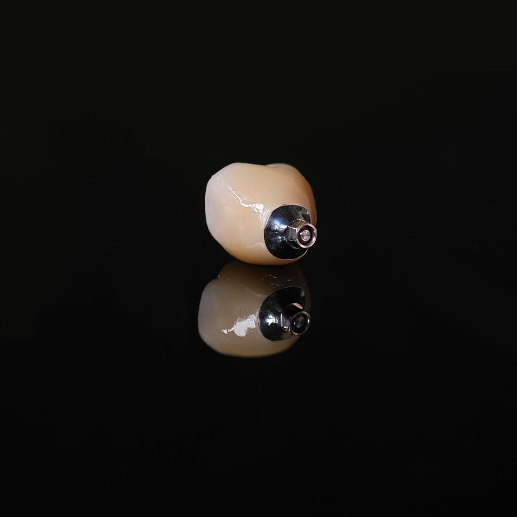 Zirconia Crown With Screw Retained