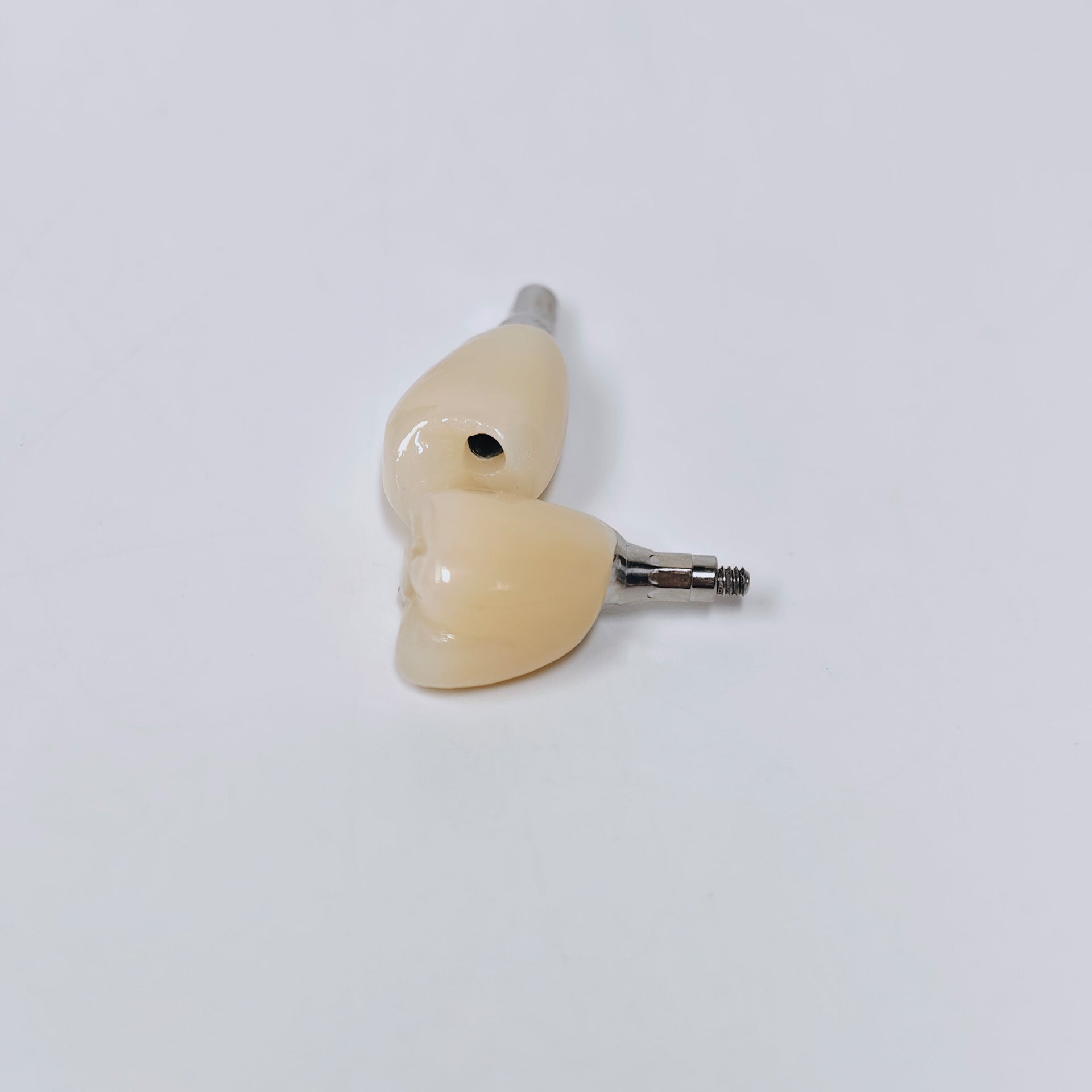 Zirconia Crown With Screw Retained