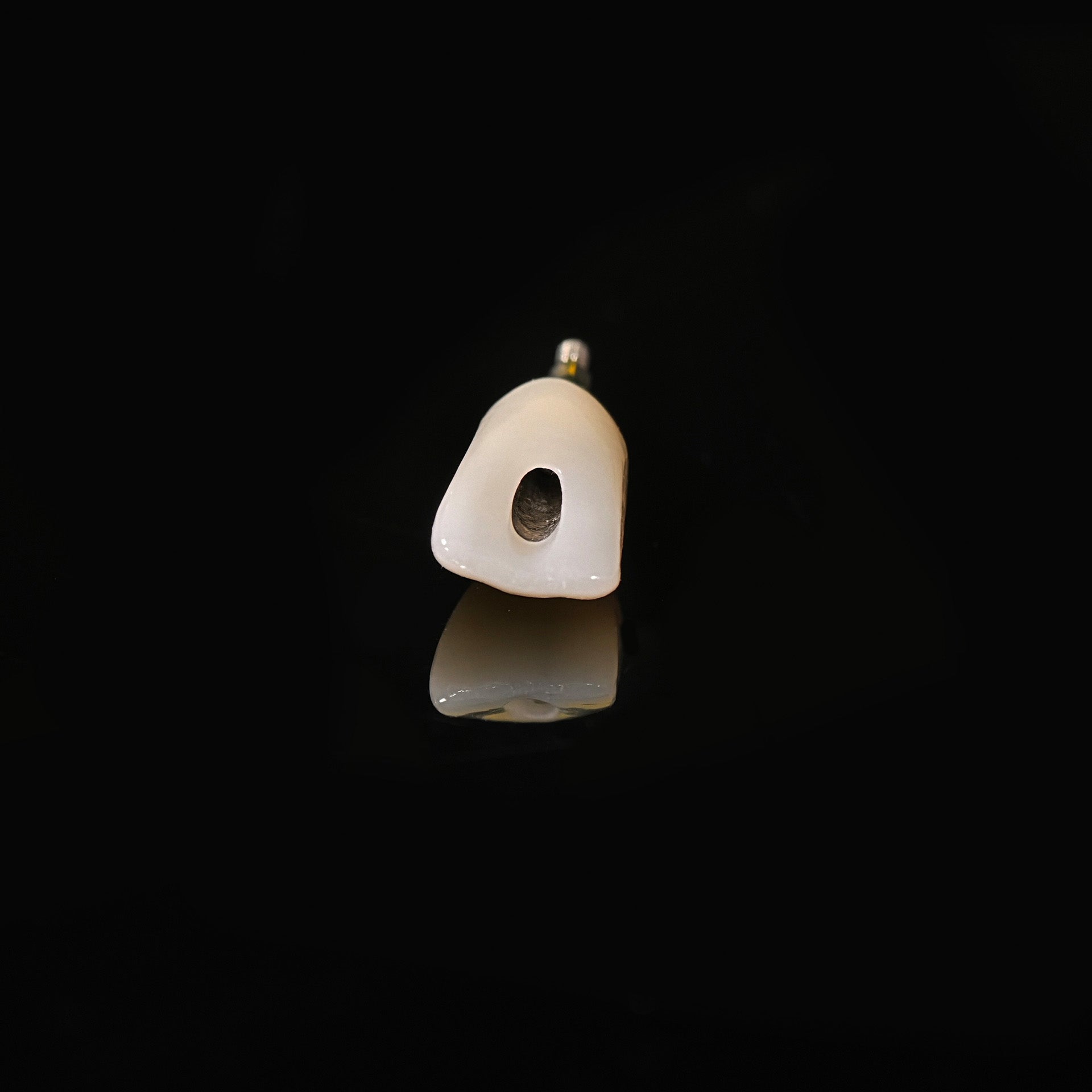 Zirconia Crown With Screw Retained