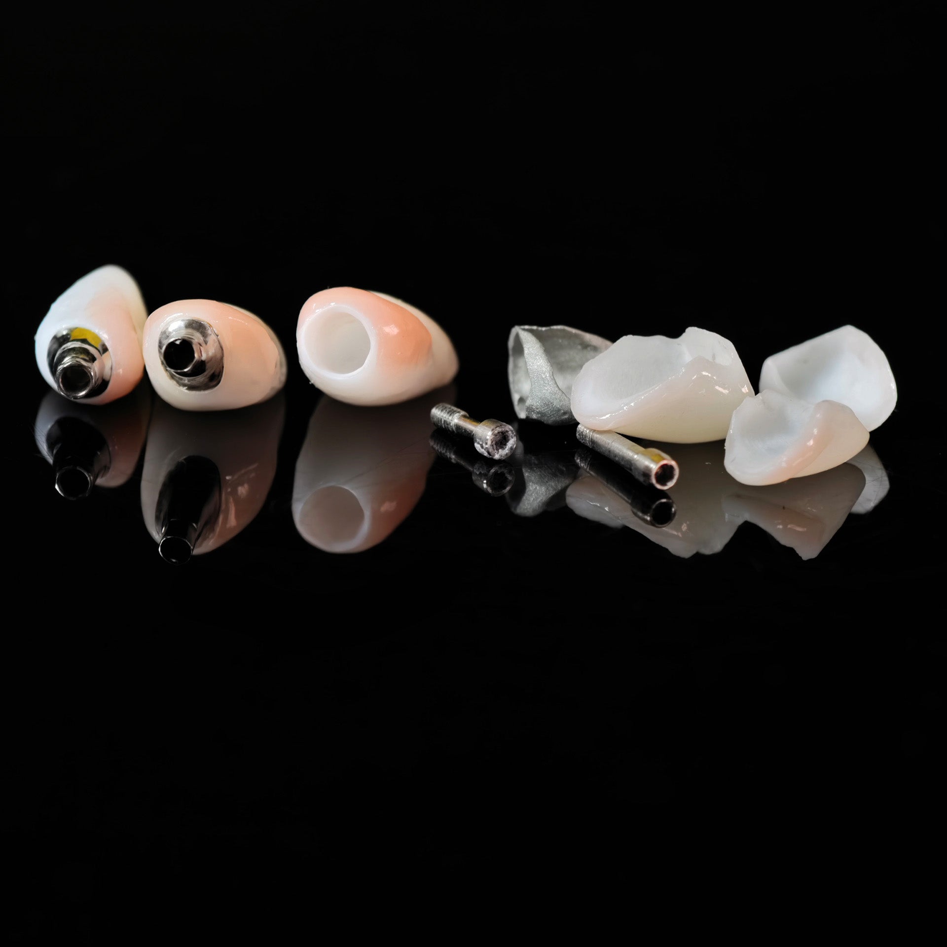 Zirconia Crown With Screw Retained And Cement Retained And Ceramic Veneers