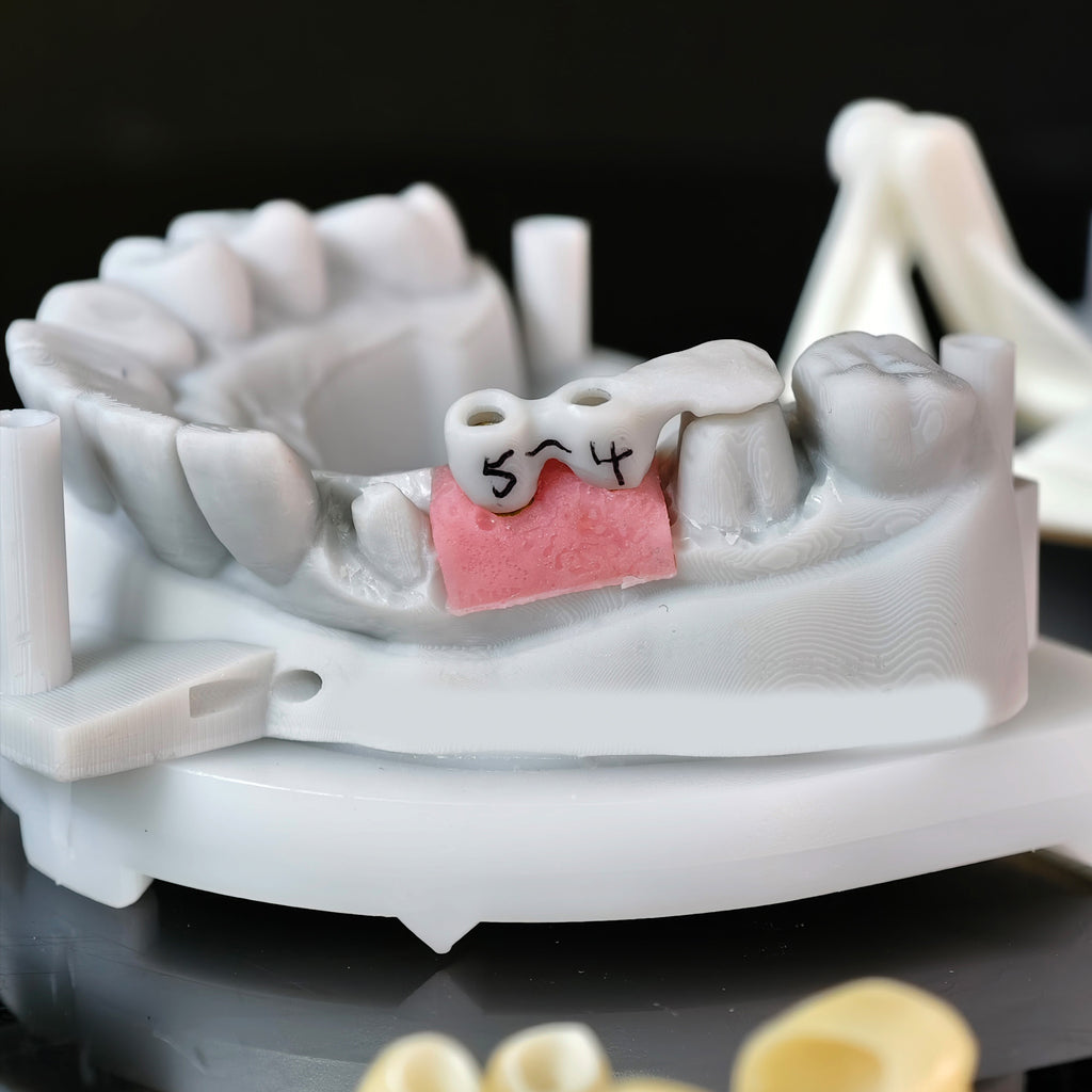Zirconia Implant Bridge Screwmentable Dental Crown