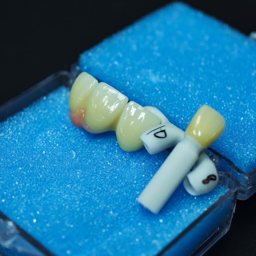 Zirconia Implant Bridge Screwmentable Dental Crown