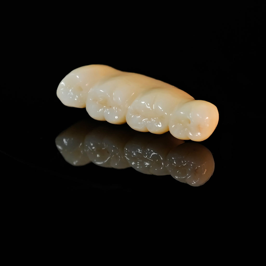 Zirconia Implant Bridge Screwmentable Dental Crown