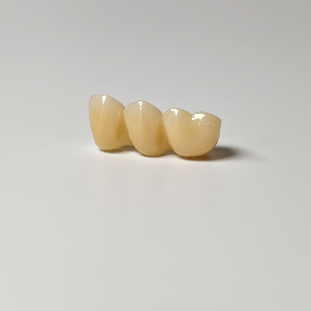 Zirconia Implant Bridge Screwmentable Dental Crown