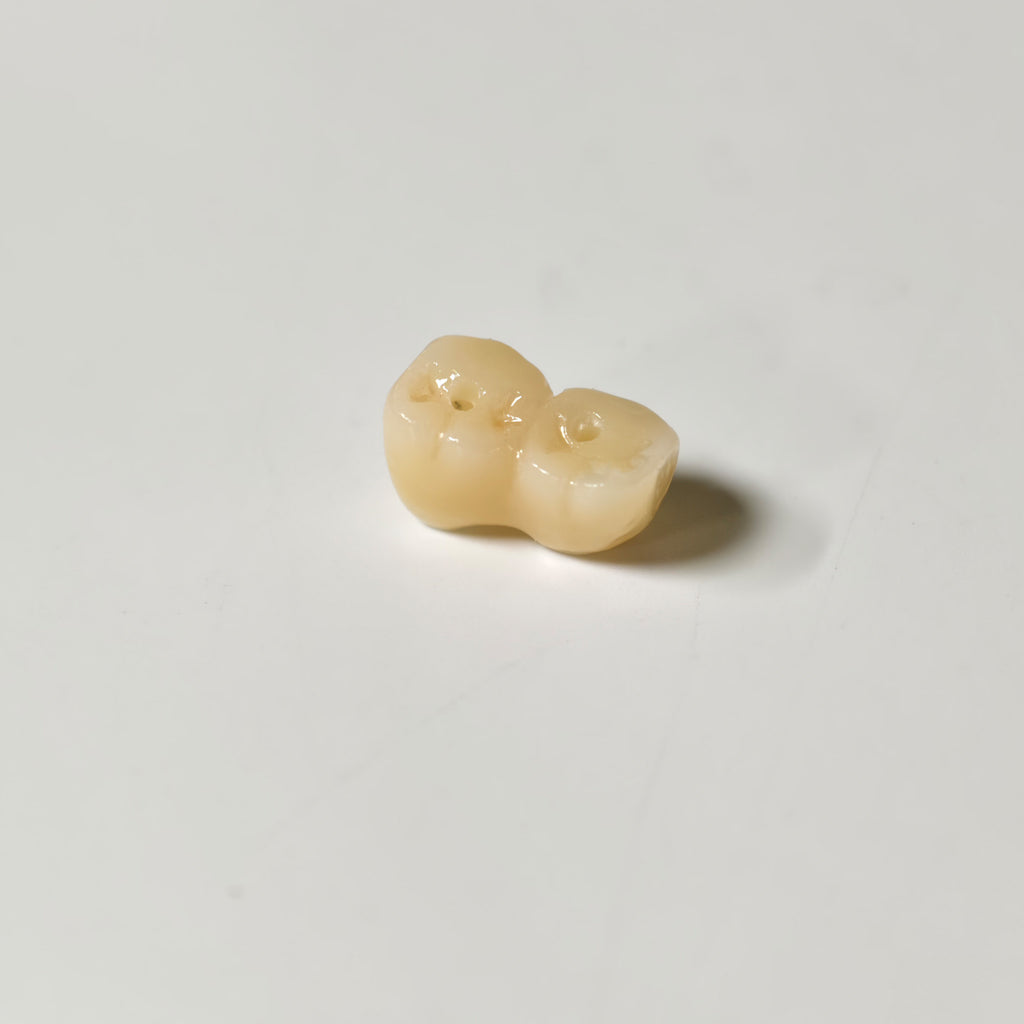 Zirconia Implant Bridge Screwmentable Dental Crown