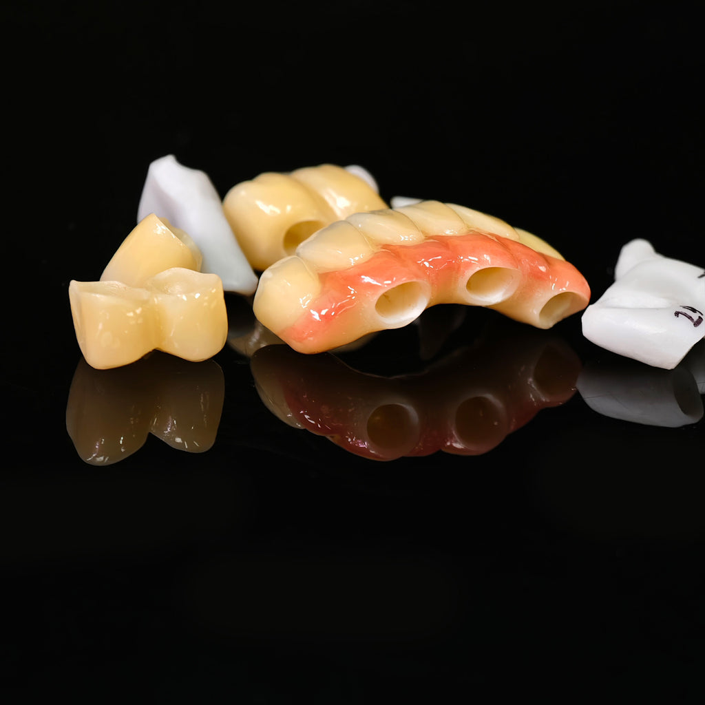 Zirconia Implant Bridge Screwmentable Dental Crown