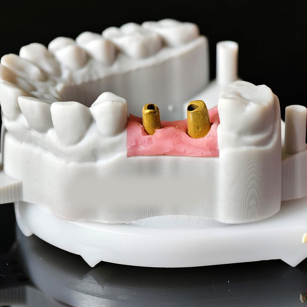 Zirconia Implant Bridge Screwmentable Dental Crown