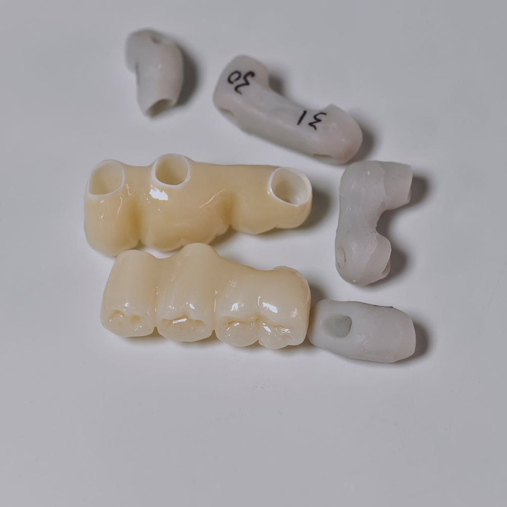 Zirconia Implant Bridges Screwmentable Dental Crown