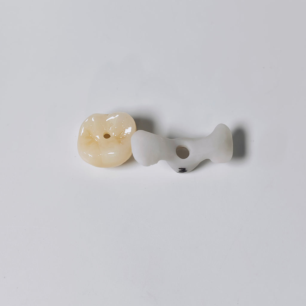 Zirconia Implant Crown Screwmentable Dental Crown