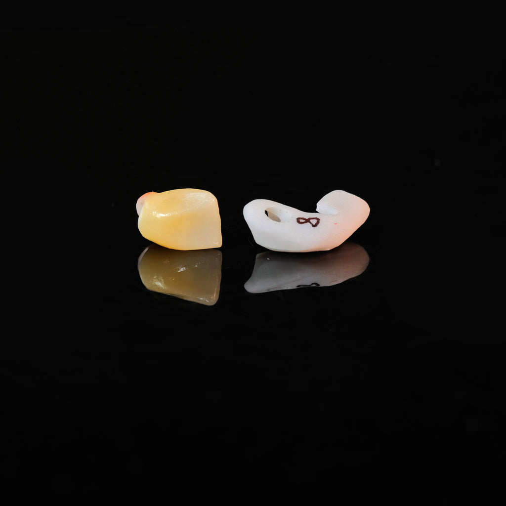 Zirconia Implant Crown Screwmentable Dental Crown