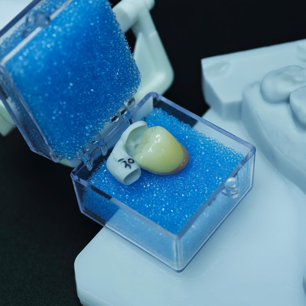 Zirconia Implant Crown Screwmentable Dental Crown