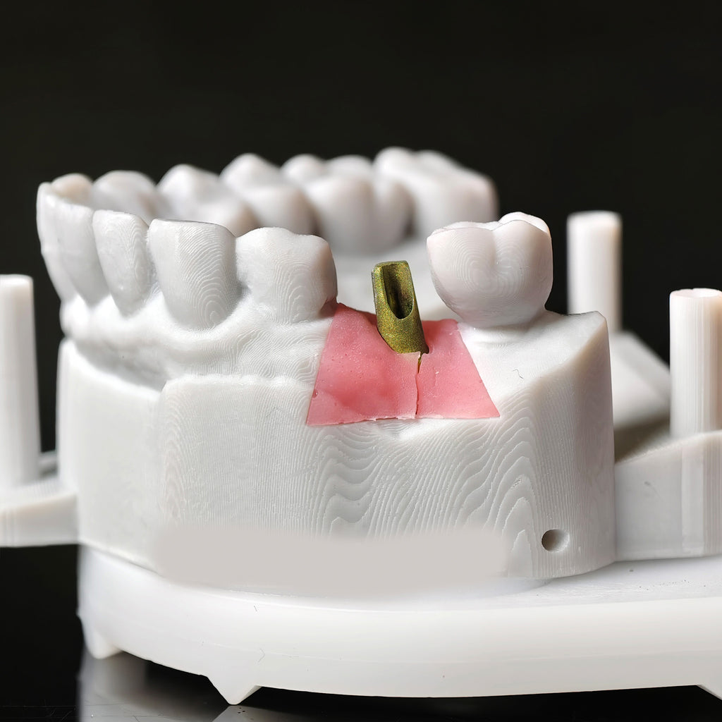 Zirconia Implant Crown Screwmentable Dental Crown