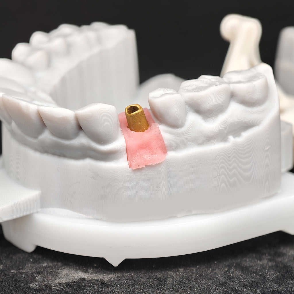 Zirconia Implant Crown Screwmentable Dental Crown