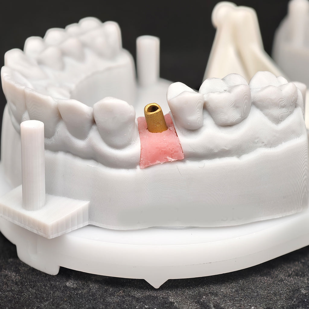 Zirconia Implant Crown Screwmentable Dental Crown