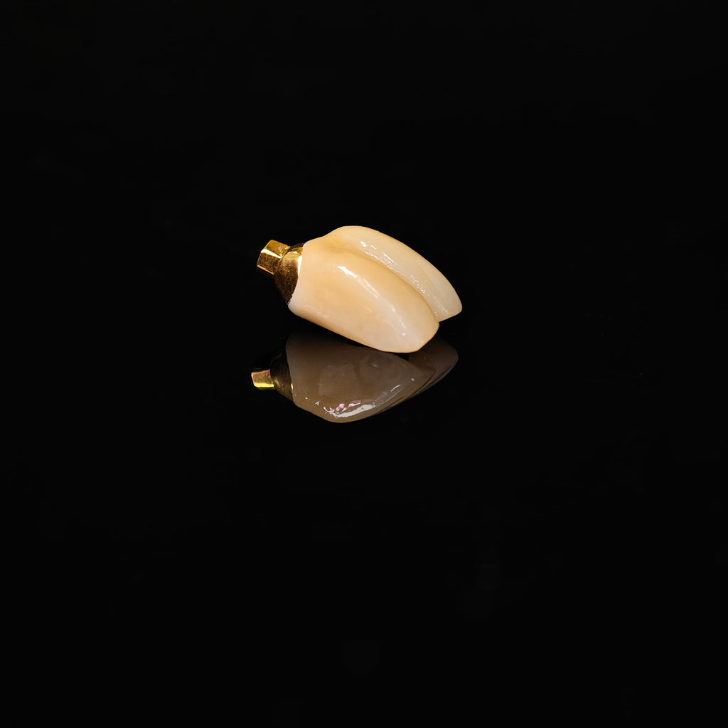 Zirconia Implant Crown With Gold Plating