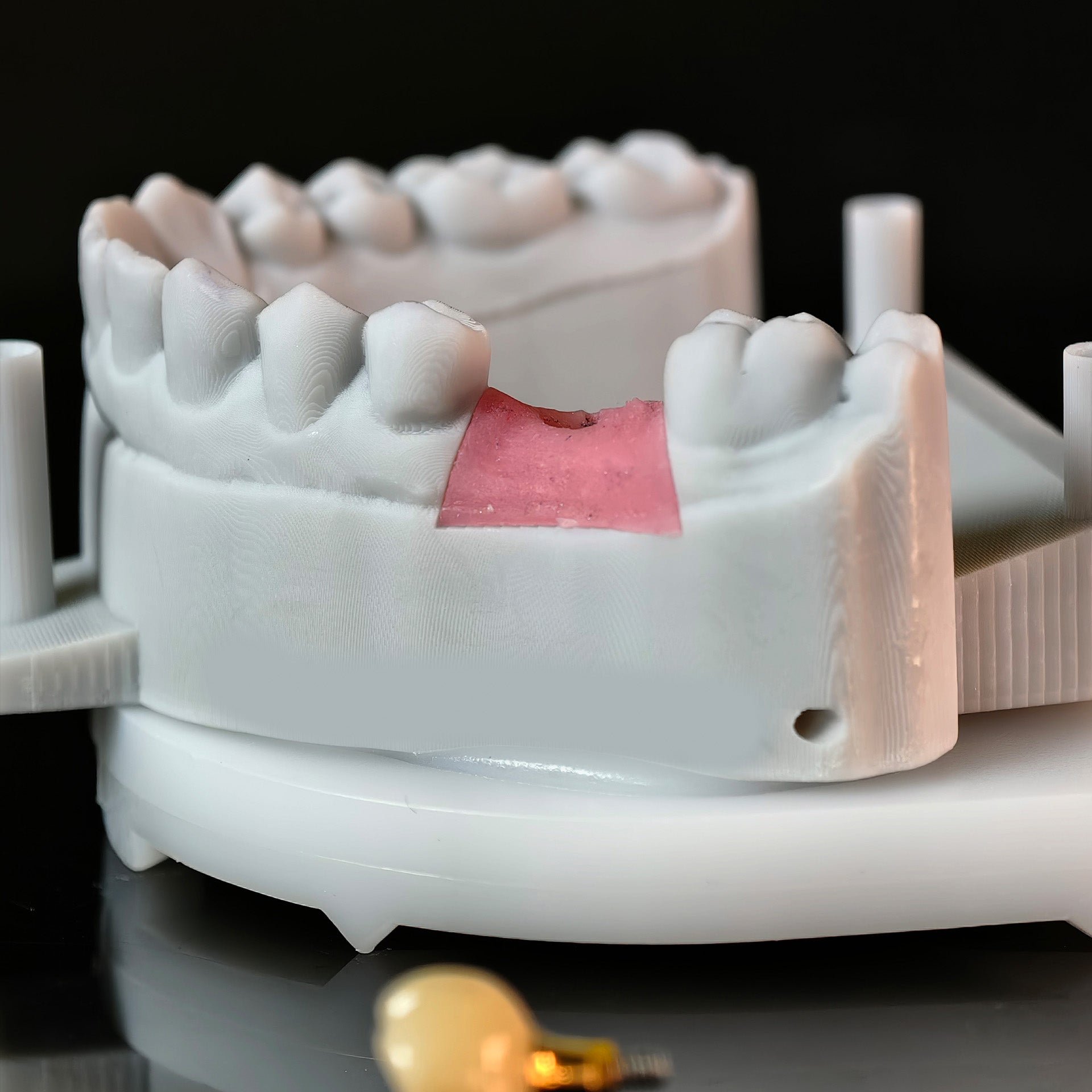 Zirconia Implant Crown With Gold Plating