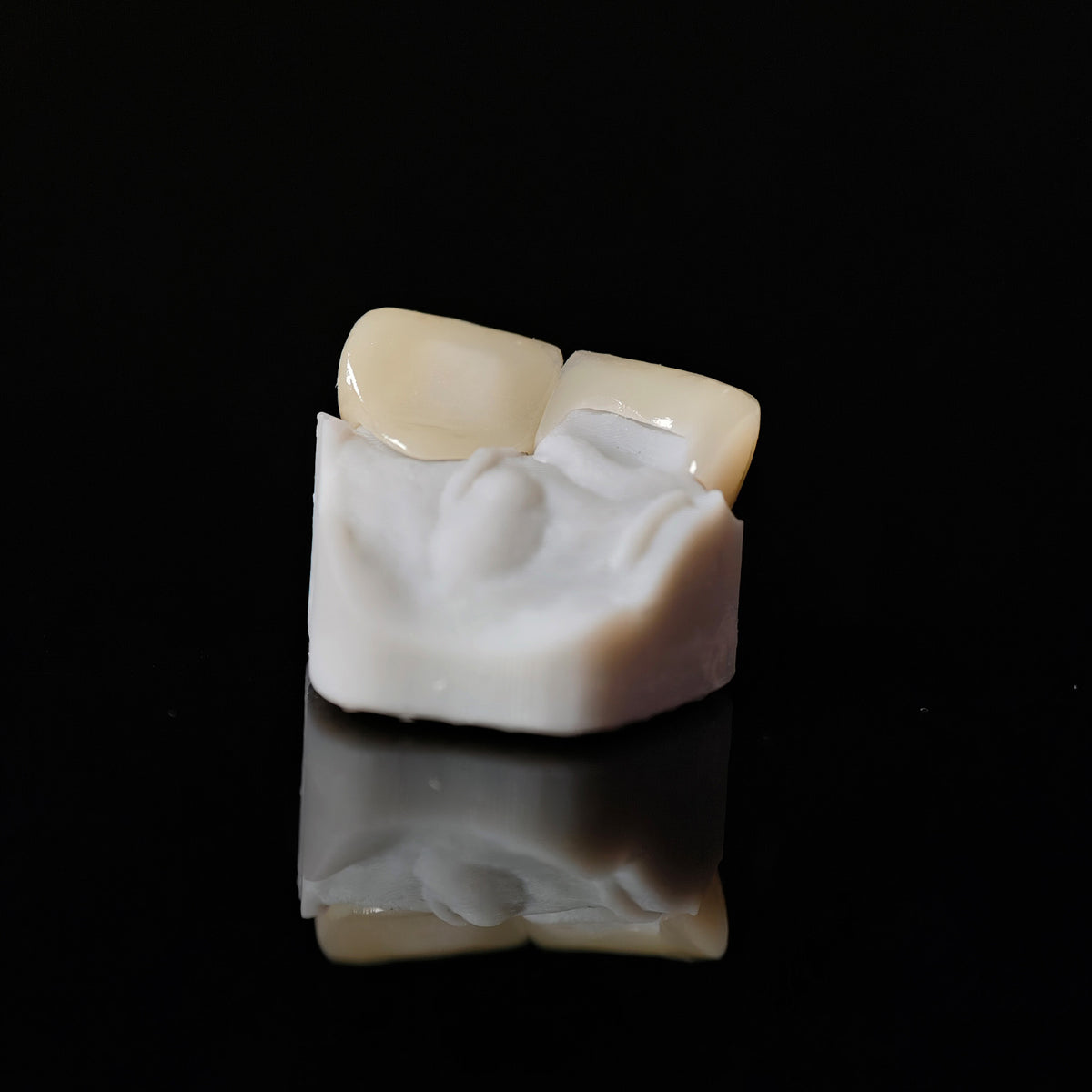 Zirconia Veneer. High Transparency/Translucent, Natural Shade