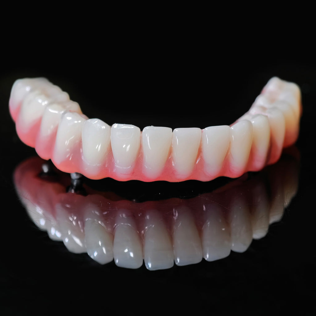 Acrylic Denture With Screw Retained