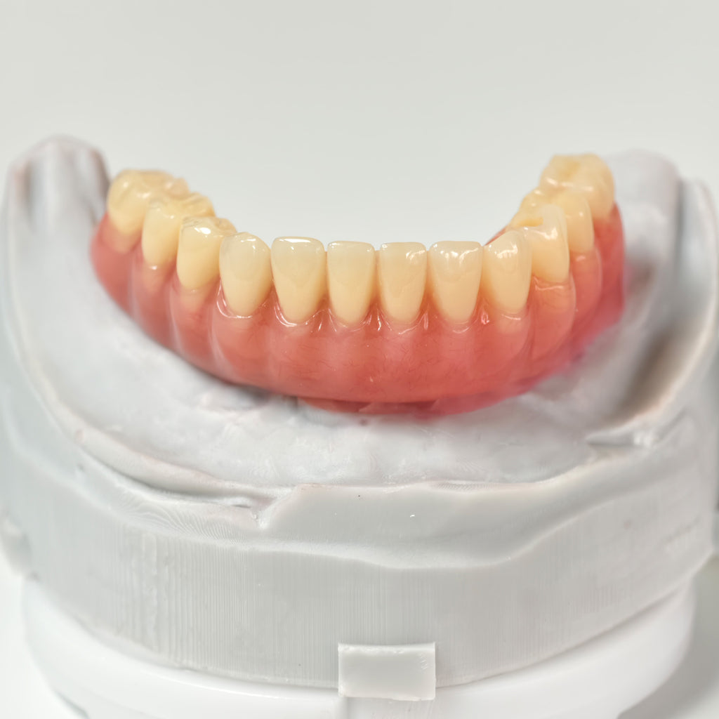 Acrylic Denture With Ti-Bar And Screw Retained