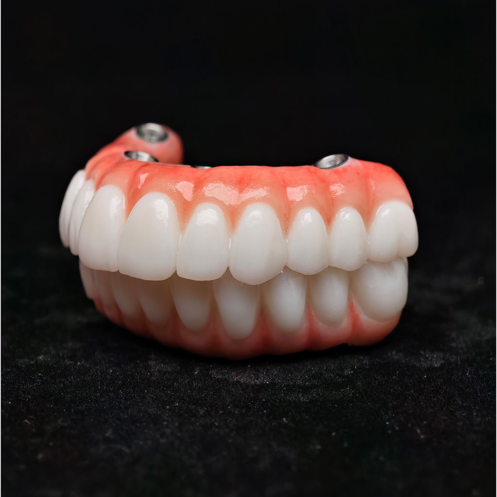 All On 4 Zirconia Bridge With Ti-Base Screw Retained Trying For Full Arch Restoration