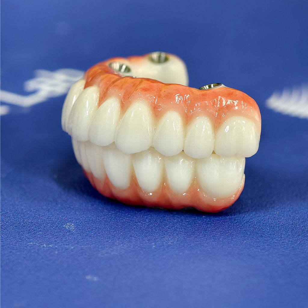 All On 4 Zirconia Bridge With Ti-Base Screw Retained Trying For Full Arch Restoration