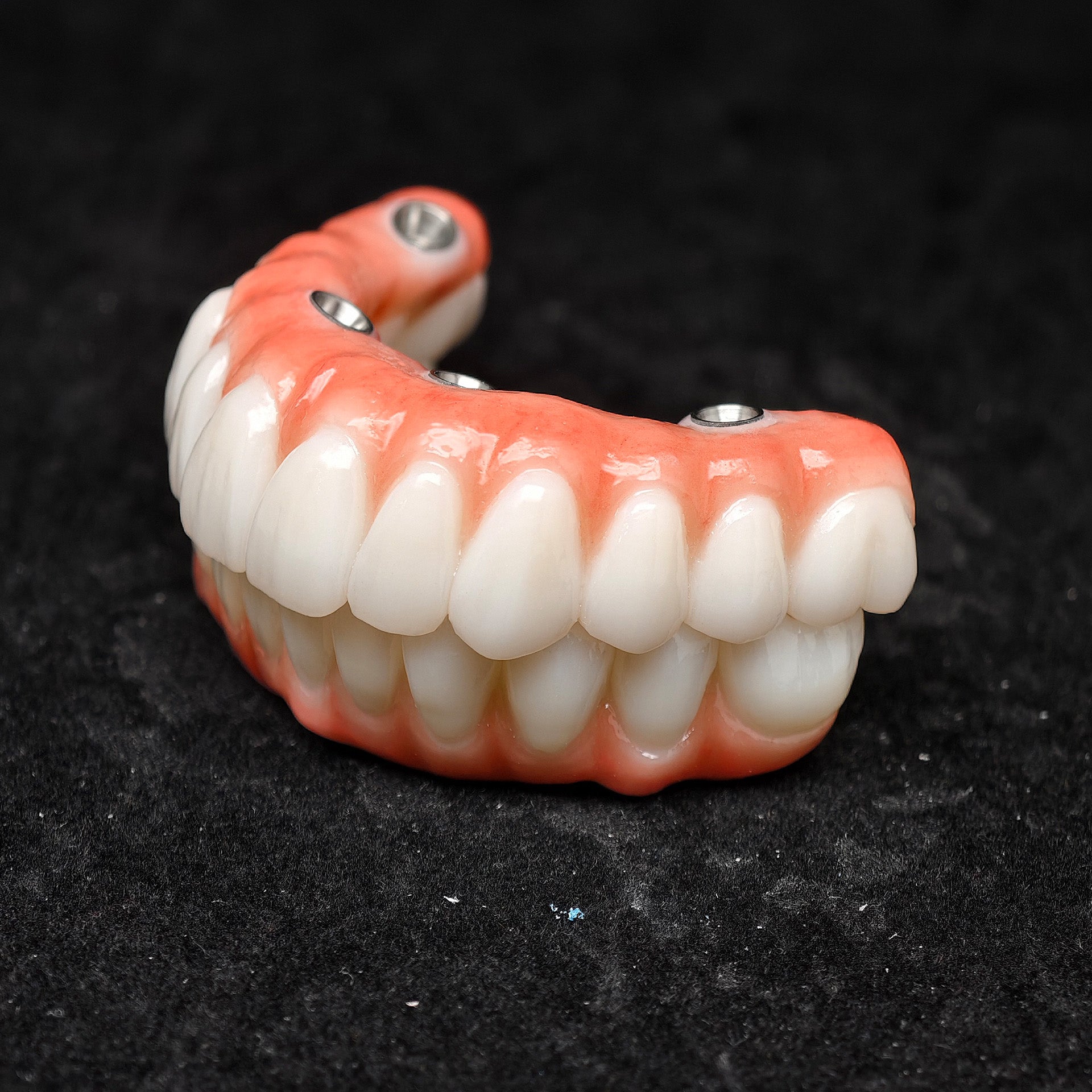 All On 4 Zirconia Bridge With Ti-Base Screw Retained Trying For Full Arch Restoration