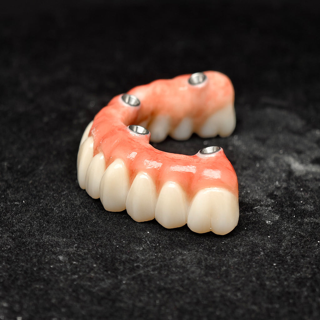 All On 4 Zirconia Bridge With Ti-Base Screw Retained Trying For Full Arch Restoration