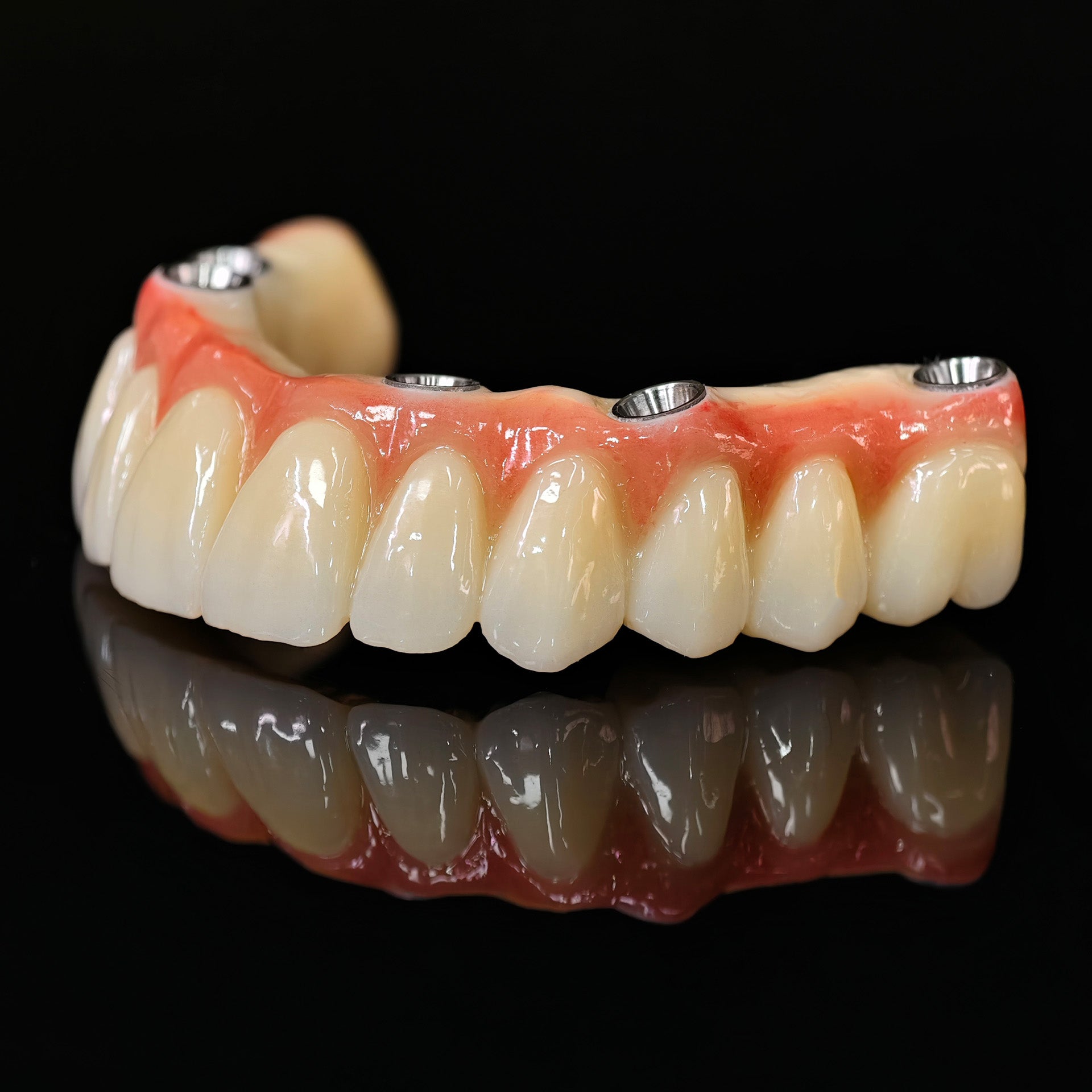 All On 5 Zirconia Bridge With Ti-Base Screw Retained Trying For Full Arch Restoration