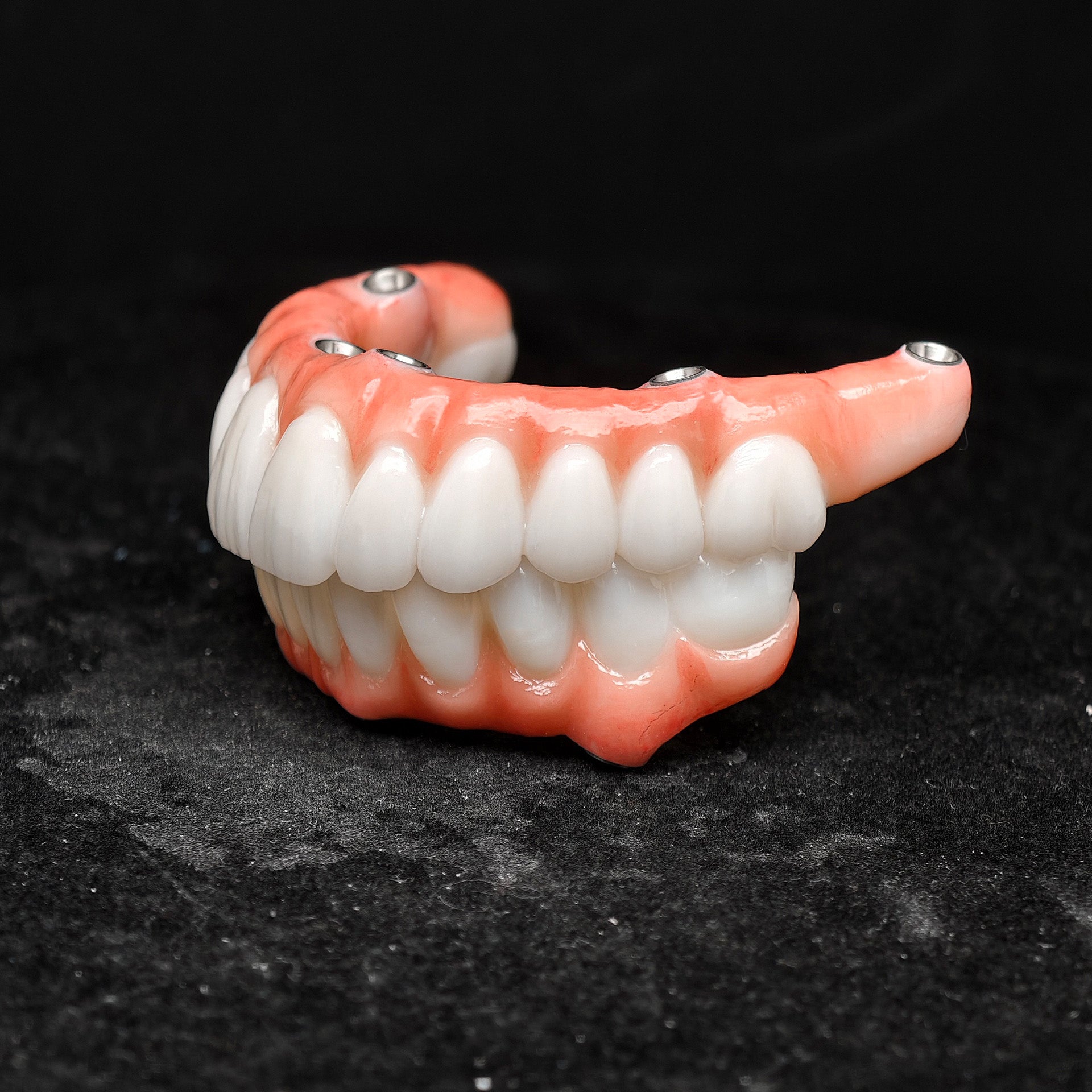 All On 5 Zirconia Bridge With Ti-Base Screw Retained Trying For Full Arch Restoration