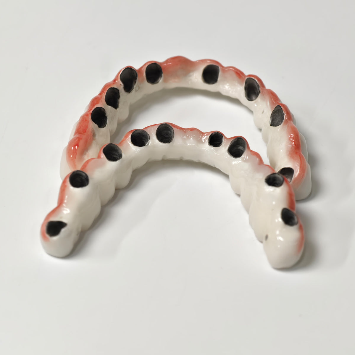 Full-Arch PFM Bridge With Screw Retained