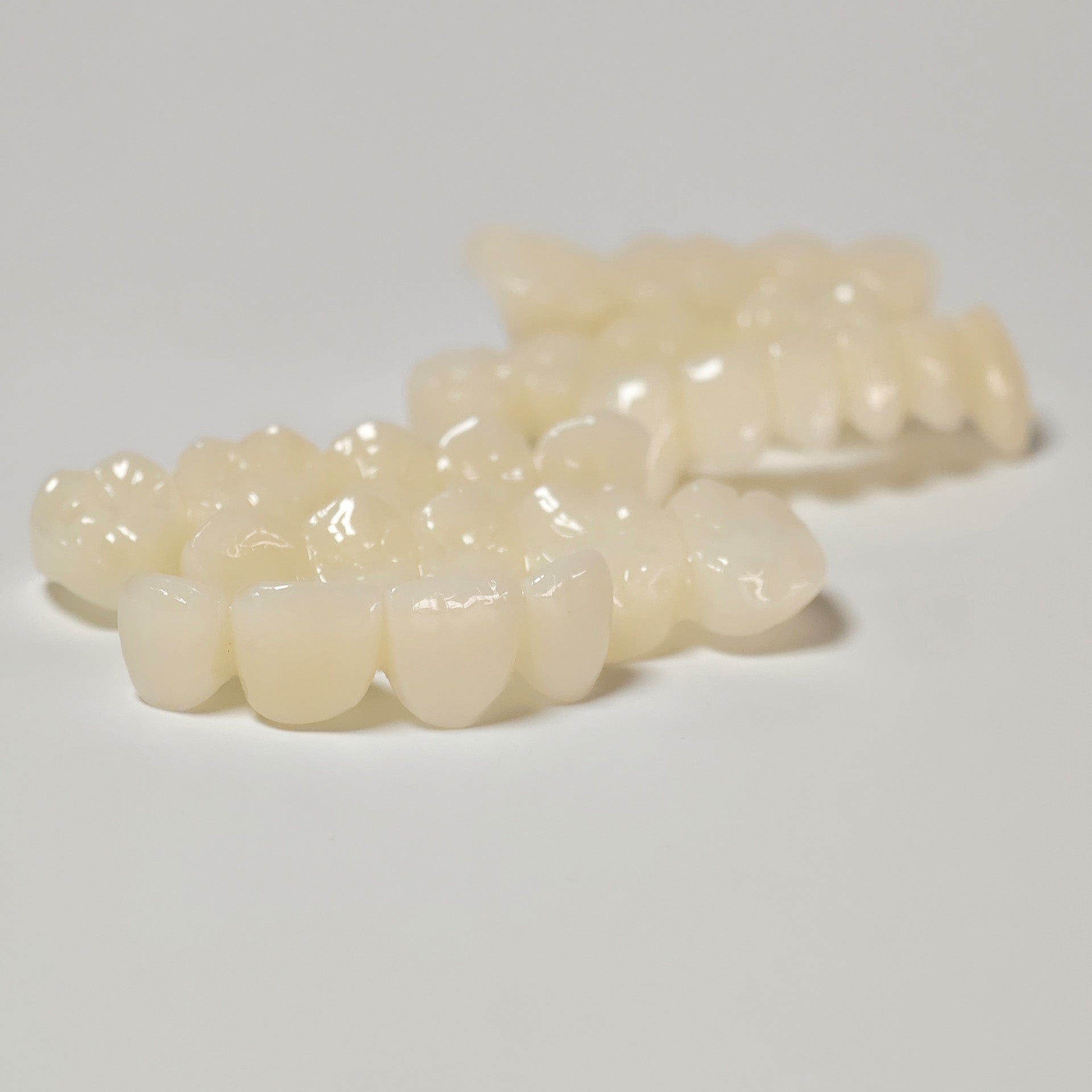 Full-Mouth Segmented PMMA Bridge With Cement Retained