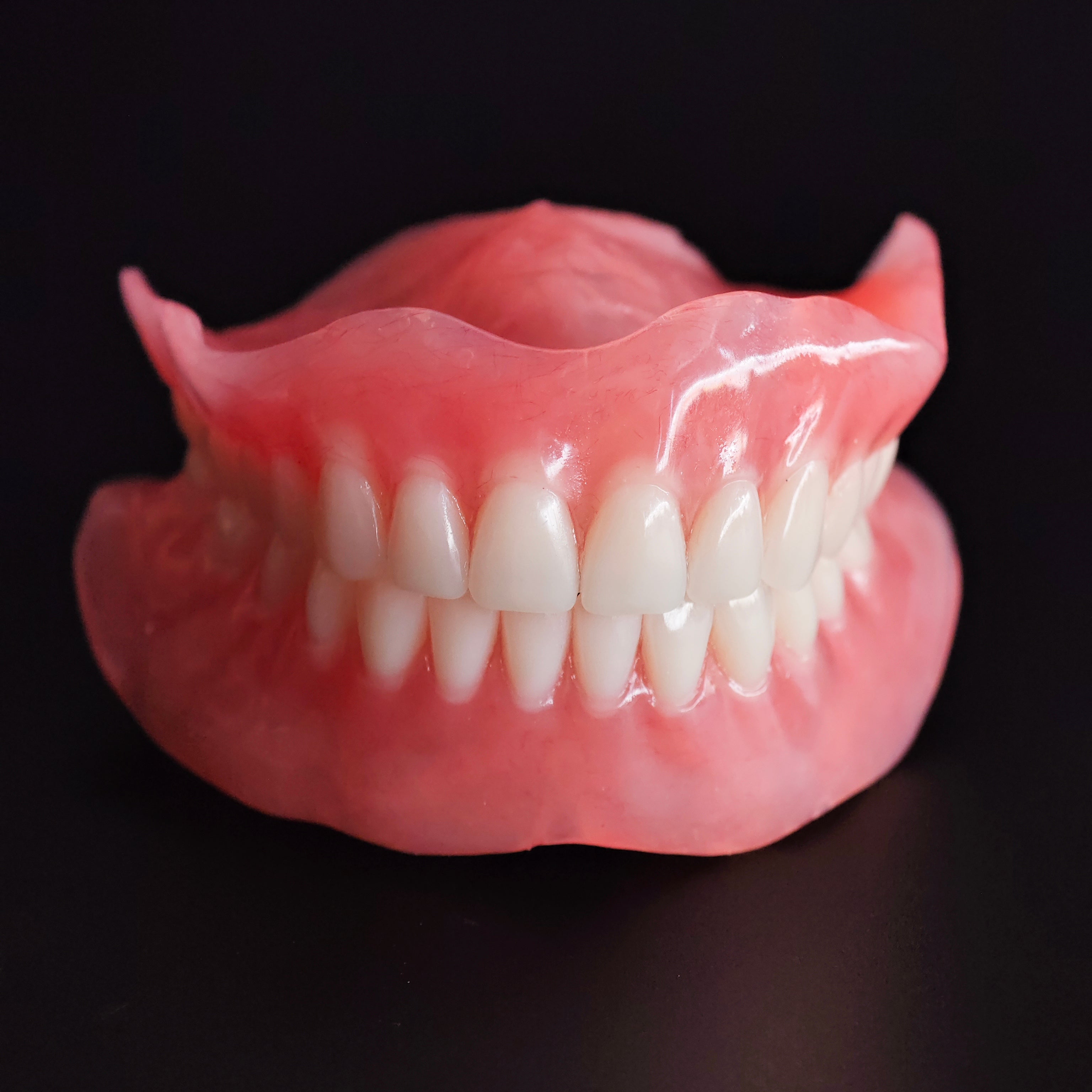 Full-Mouth Acrylic Denture