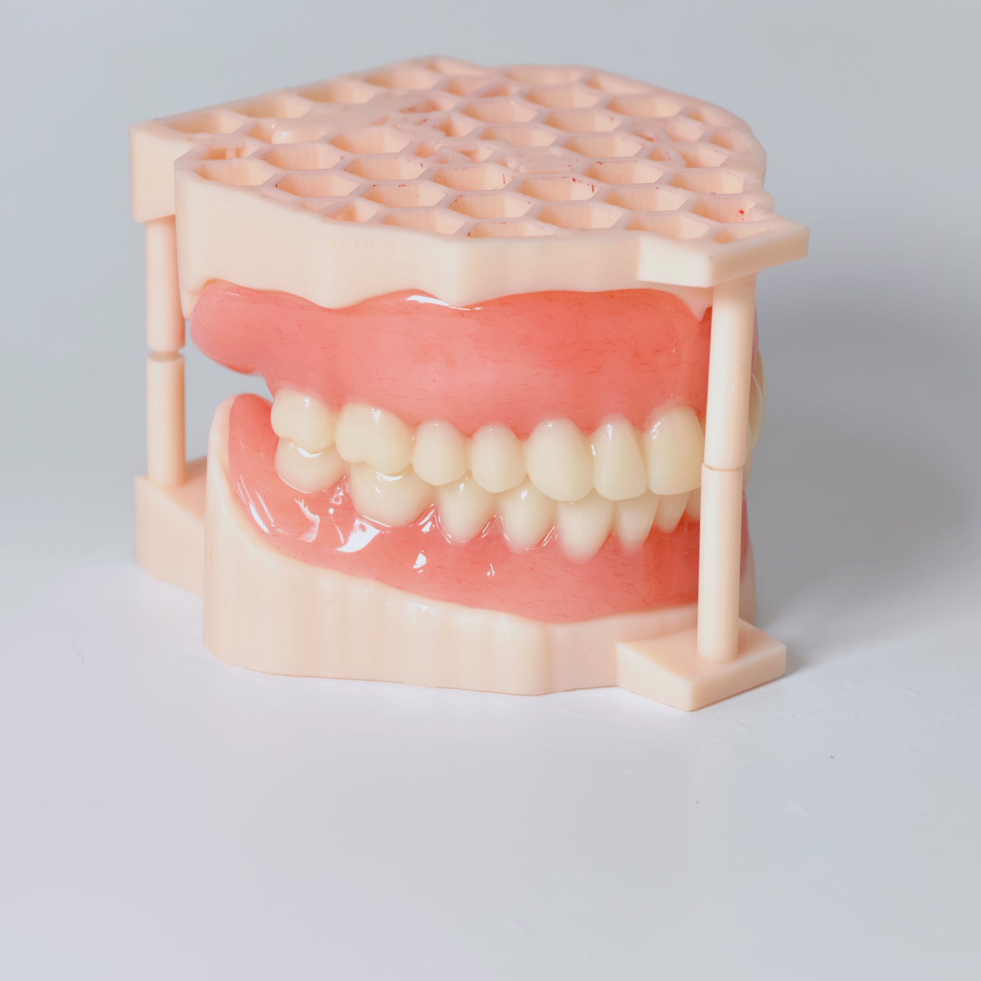 Full-Mouth Acrylic Denture
