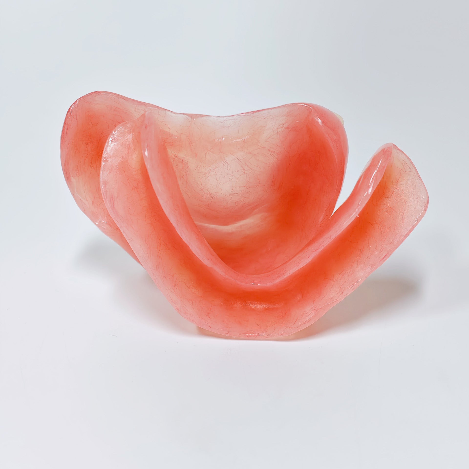 Full-Mouth Acrylic Denture