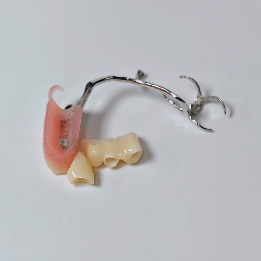 Full-Zirconia Crown And Bridge With Cement Retained And Co-Cr Frame Partial Denture