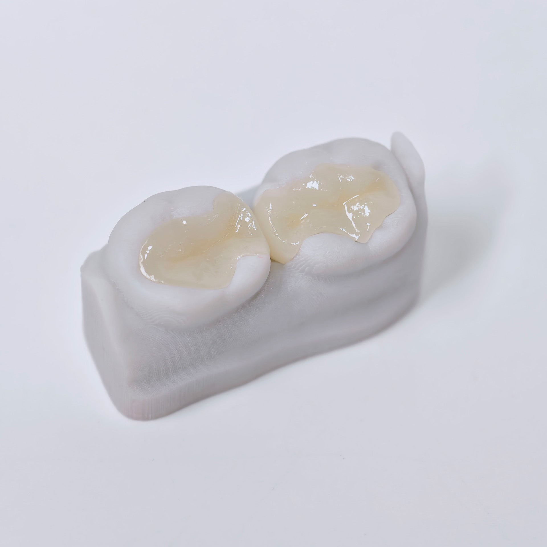 Full-Zirconia Laying With Cement-Retained