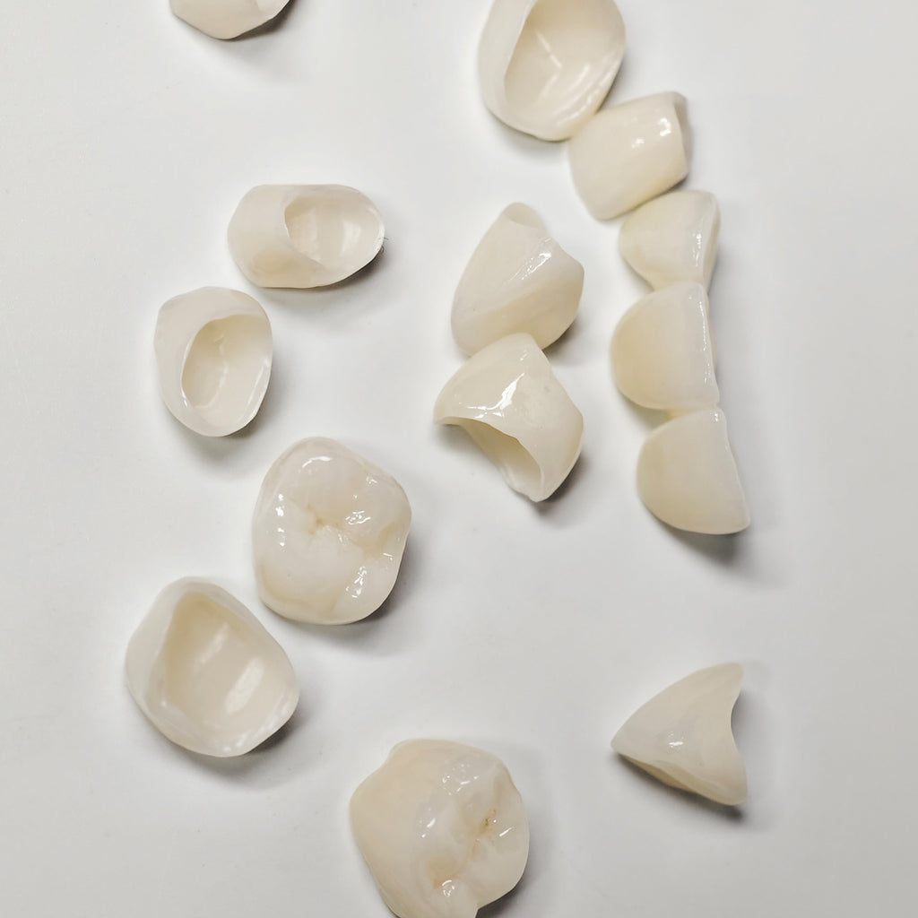 Full-Zriconia Crowns With Cement-Retained