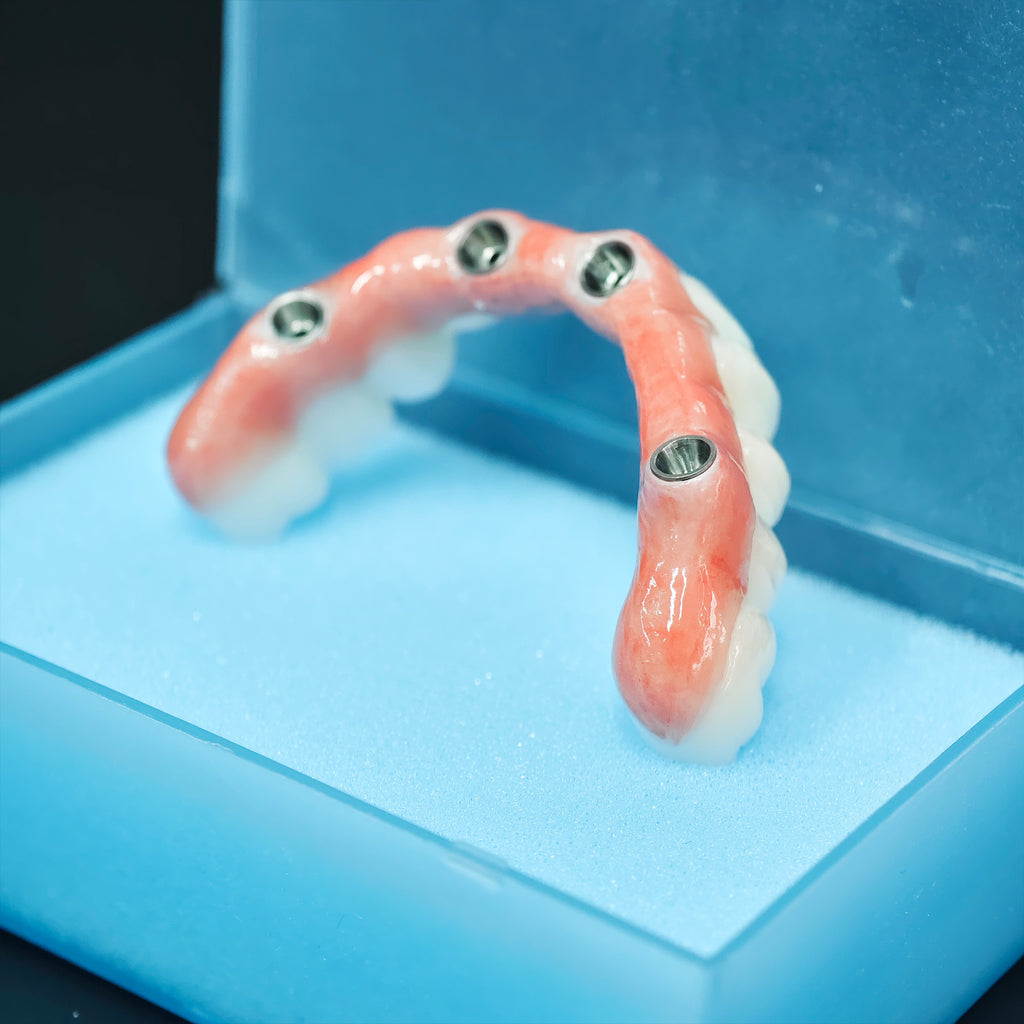 Zirconia Bridge With Ti-Base Abutment