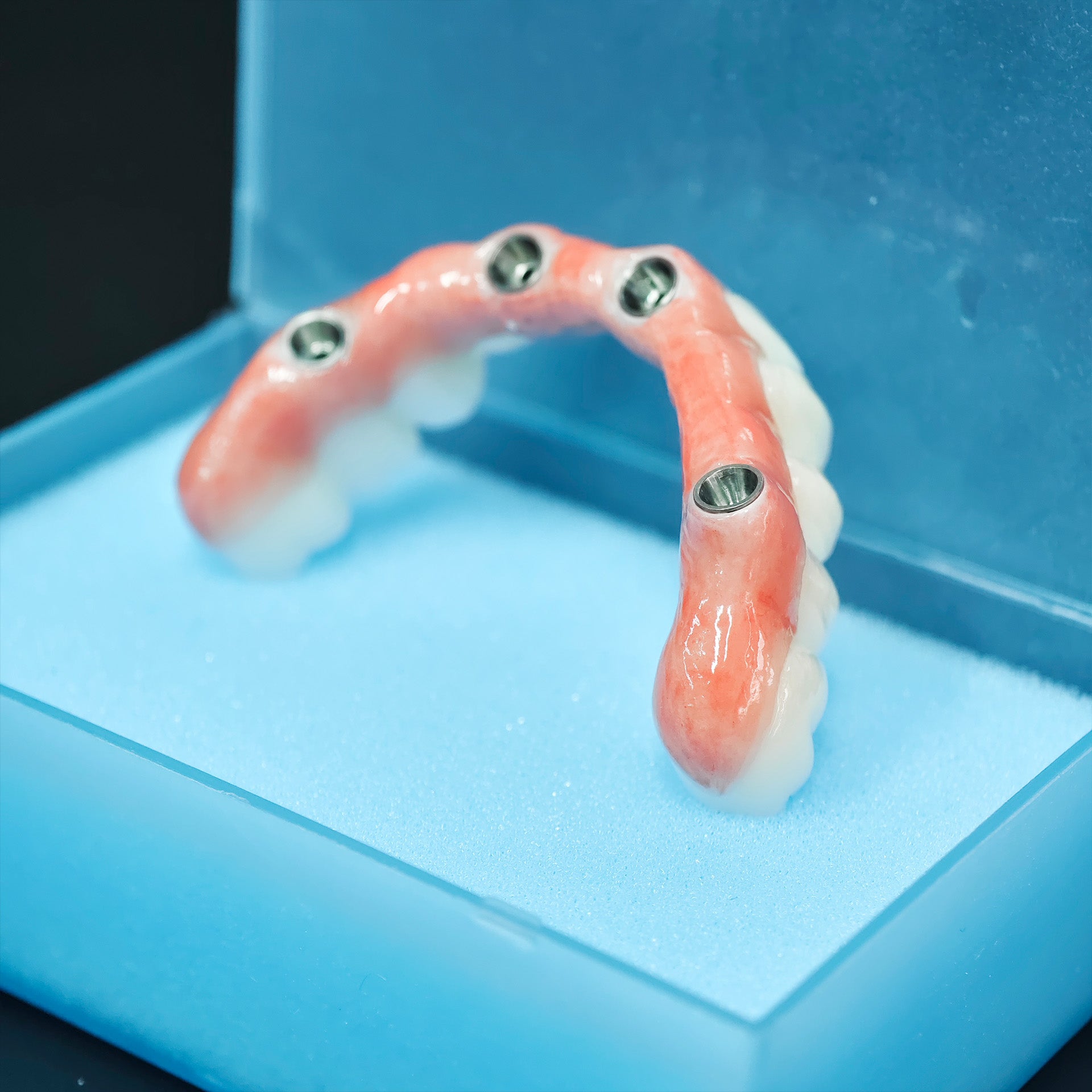 Zirconia Bridge With Ti-Base Abutment