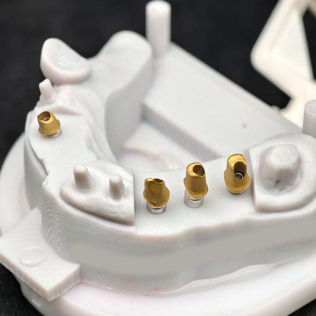 Zirconia Crown And Birdge With Cemented And Implant Seating Guide