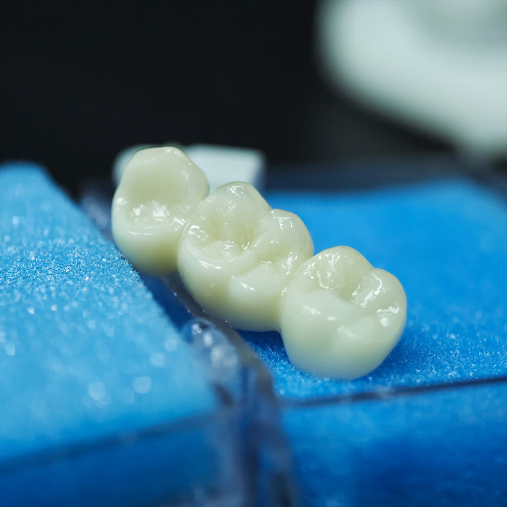 Beautiful Zirconia Bridge