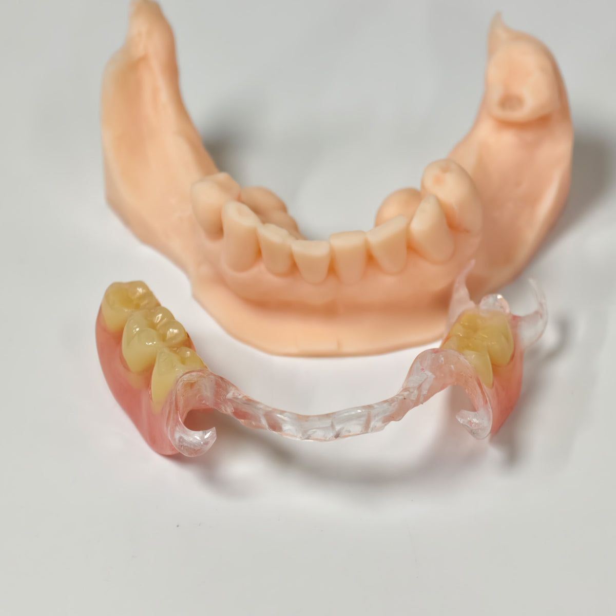 Clear Framework With Acrylic Denture Aesthetic Denture