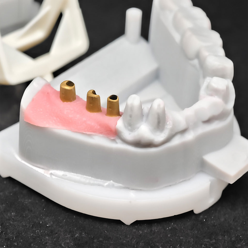 Co - Cr PFM Dental Bridge
